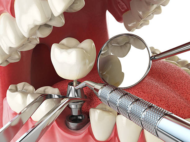 Best Broken or Cracked Tooth Emergency Dentist in Mound Bayou, MS